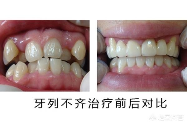 嘉善最新24小时牙医在线咨询方法分析(最方便真实的嘉善有没有24小时牙医方法)